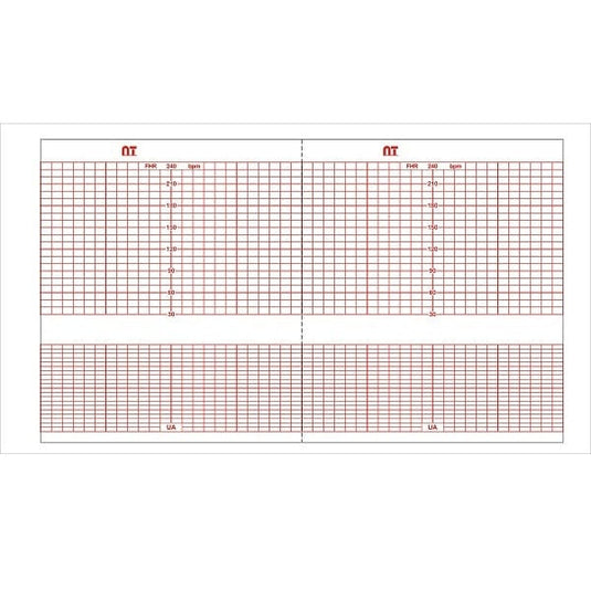Papel Térmico para Tococardiógrafo General Electric E9005JA De 14 CM X 43 MTS  – Catálogo: NT 4483AAO