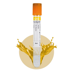 CY-103SGC (6ml)-1200 Vacutainer con Gel y Activador de Coágulo 13×100 mm 6 ml plástico PET, Tapa Color Oro - Corrugado de 12 Gradillas con 100 piezas