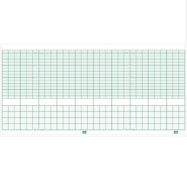 Papel Térmico para Electrocardiógrafo Bionet FC1400 De 15.2 CM X 30 MTS – Catálogo: NT 1015299