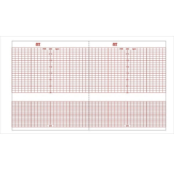 Papel Térmico para Tococardiógrafo General Electric E9005JA De 14 CM X 43 MTS  – Catálogo: NT 4483AAO